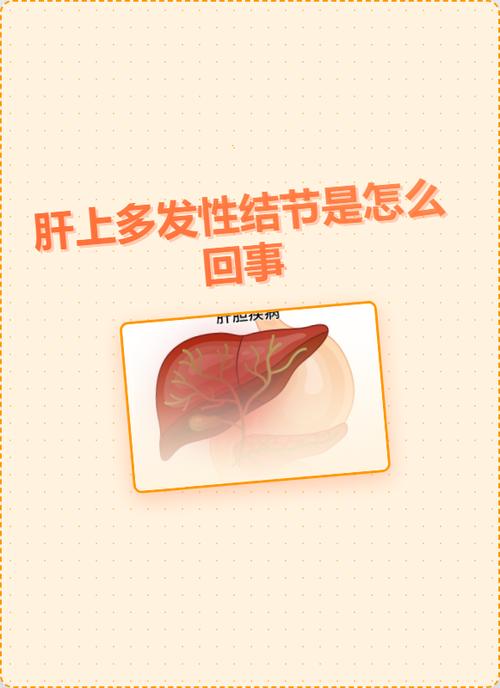 肝囊肿是什么病,需要治疗吗游戏截图